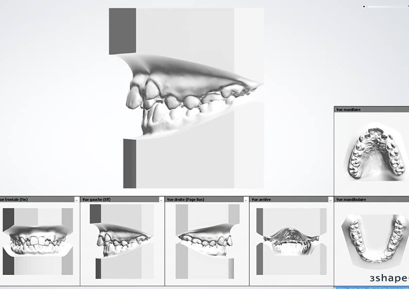 Planche PDF Moulage 3D